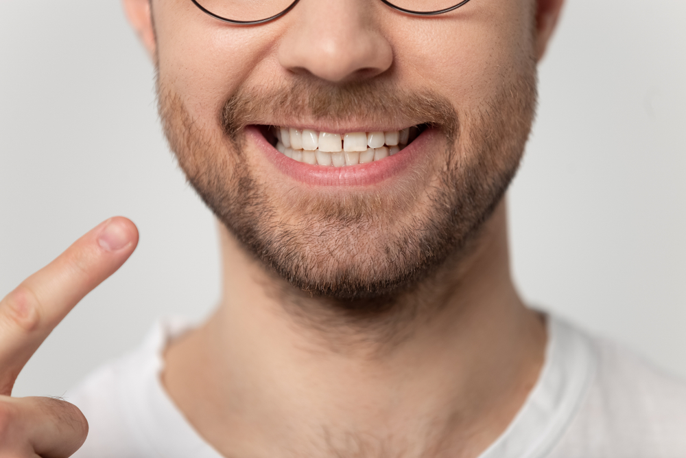 Bright Smiles with Durable Dental Crowns Close-up of man smiling and pointing to dental crowns with confidence