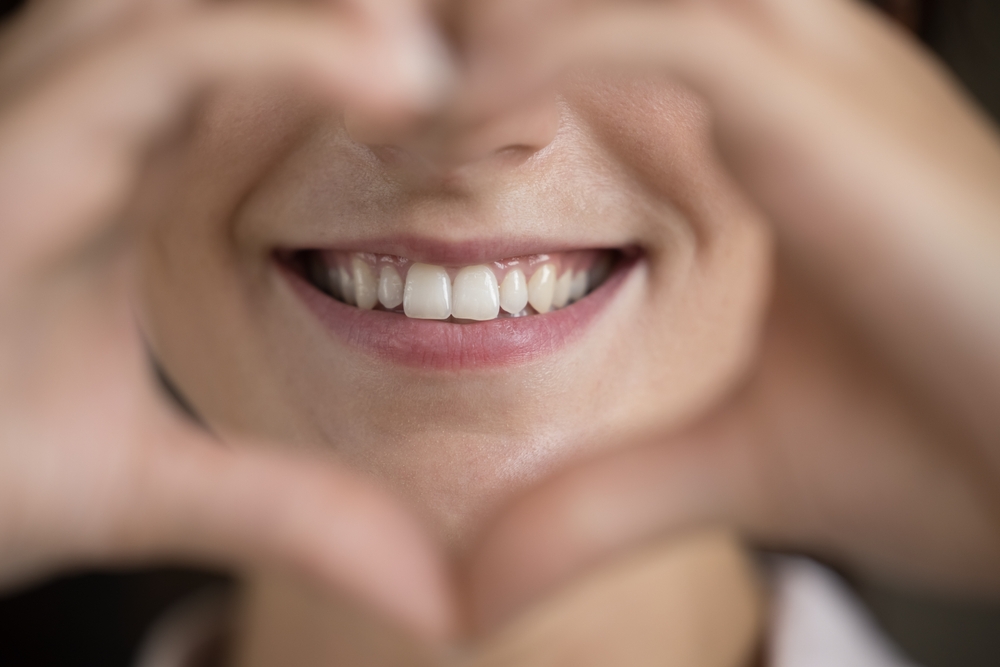 Heartwarming Smile Close-Up - Cosmetic Dentistry Close-up of a smiling woman's mouth framed by hands in heart shape, showcasing perfect teeth - Cosmetic Dentistry