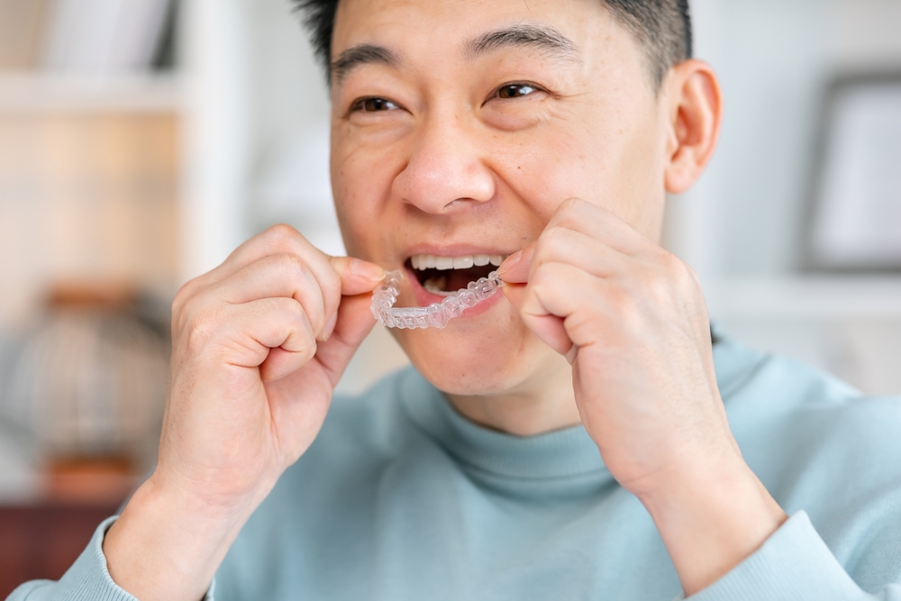A smiling man in a light blue shirt holds a clear Invisalign tray and prepares to place it in his mouth, reflecting ease of use and treatment flexibility - Invisalign Bellevue