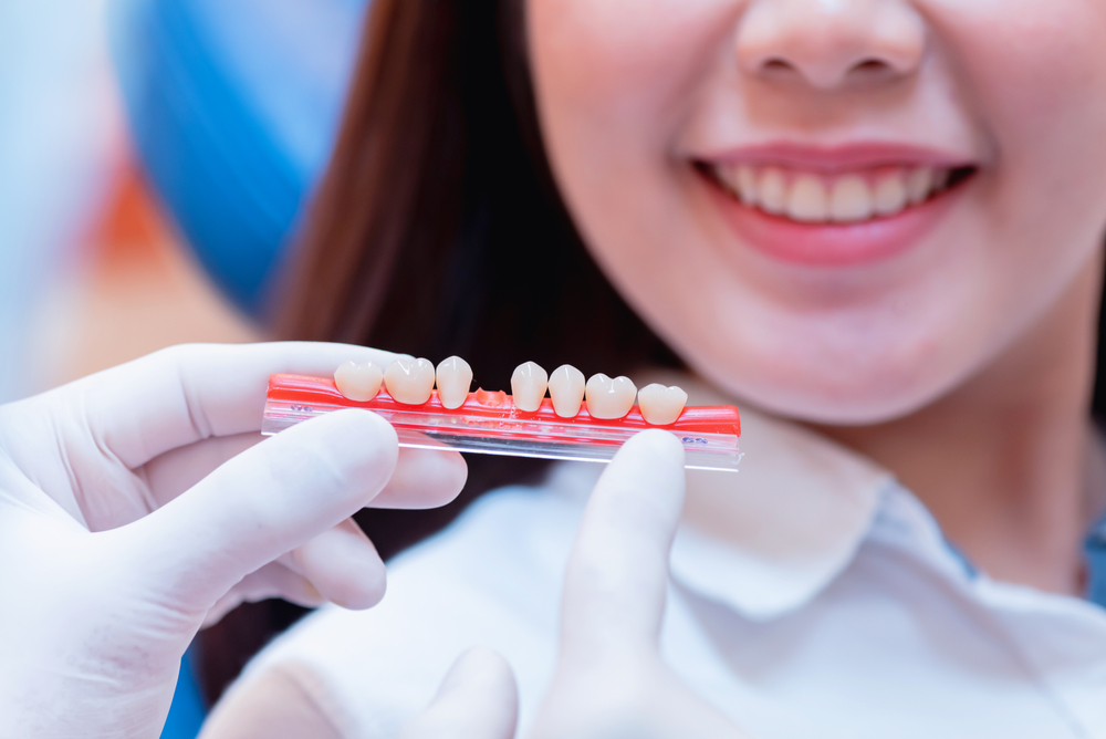A dental professional wearing gloves holds a tooth shade guide near a smiling patient’s mouth to match veneer color for a natural look – Veneers