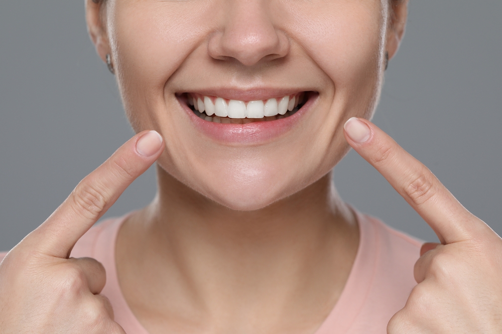 Dental Bonding for a Brighter Smile Woman pointing to her flawless teeth after a dental bonding procedure