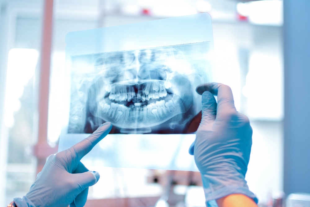 Gloved Hands Holding Dental Panoramic X-Ray in Clinic – Dental X-Rays A close-up view of a dentist’s gloved hands holding a panoramic dental X-ray film up to the light in a modern dental clinic – Dental X-Rays
