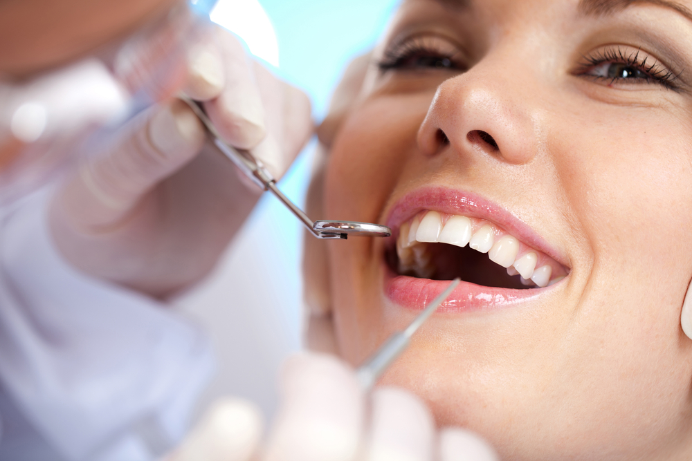 Close-up of a smiling woman receiving a dental examination as a dentist uses a mirror and probe to inspect her teeth – Extractions