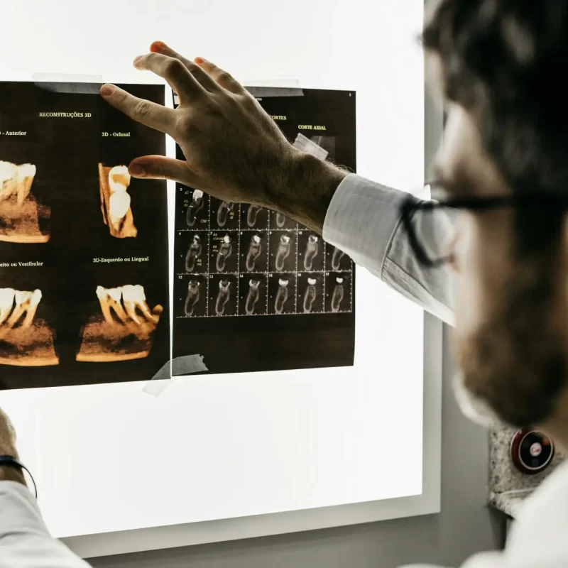 Dentist explaining how much a wisdom teeth removal costs to a patient from Bellevue