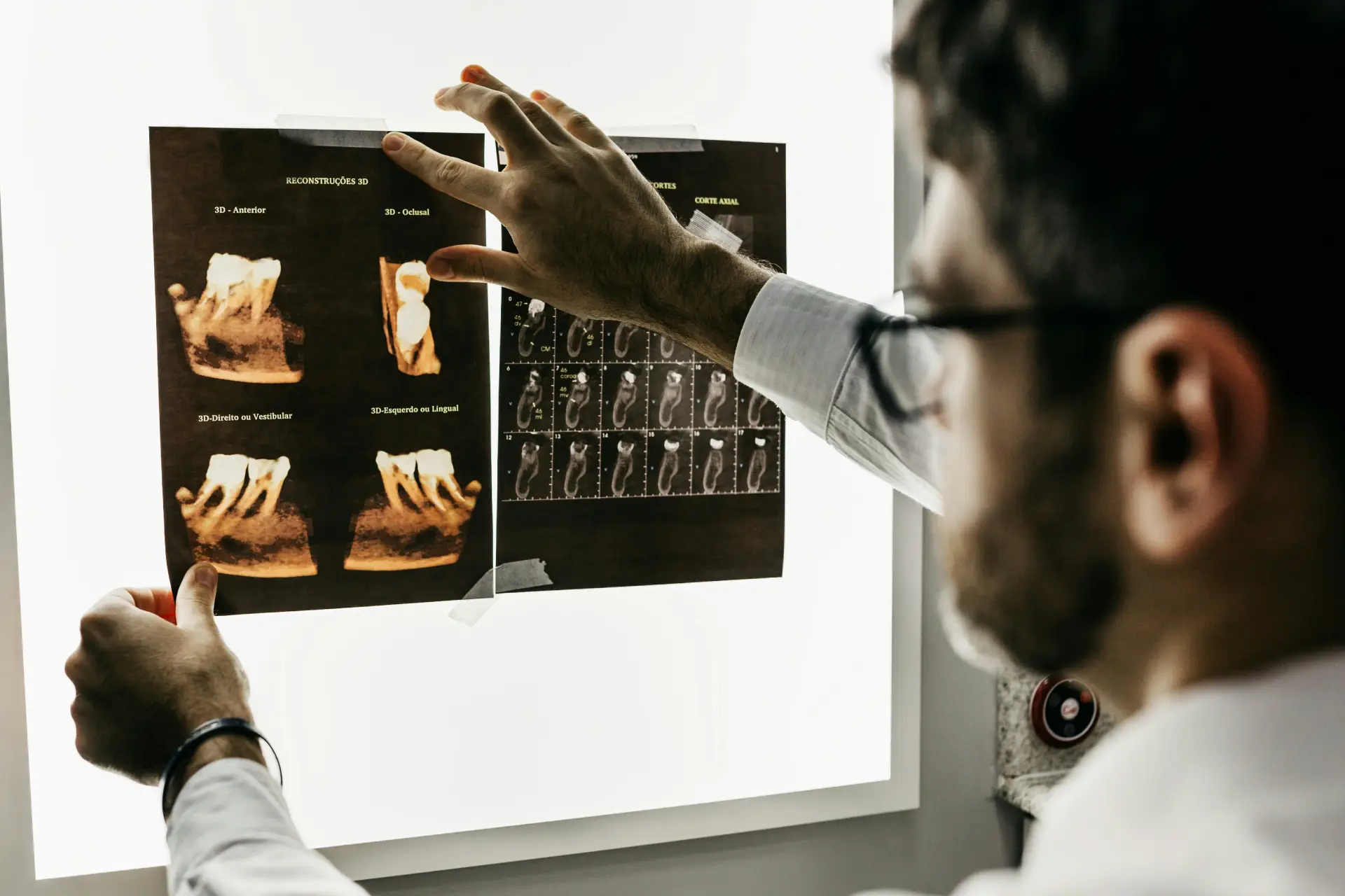 Dentist explaining how much a wisdom teeth removal costs to a patient from Bellevue